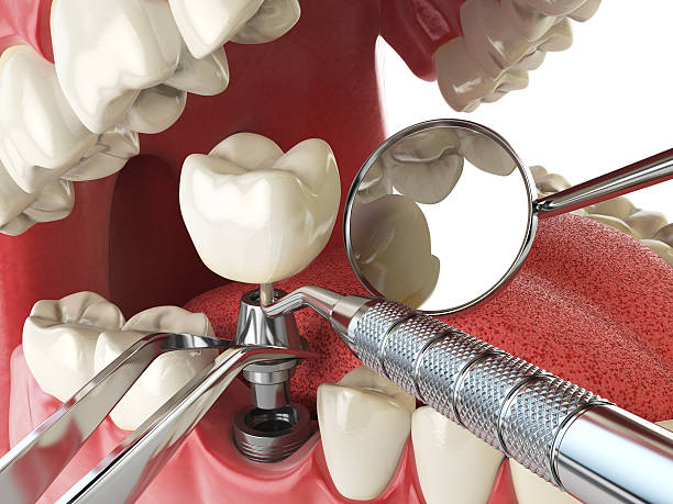 Best Emergency Dental Care for Broken or Chipped Teeth in Marion, PA
